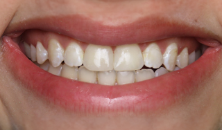 Dental Wellness LA | Preventative Program, CEREC and Botox reg