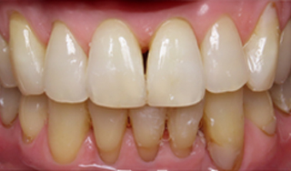 Dental Wellness LA | Orthodontics, ClearCorrect reg and Emergency Treatment