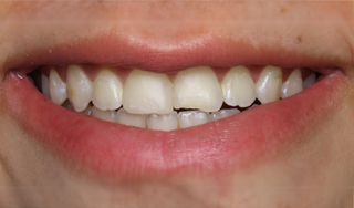 Dental Wellness LA | Teeth Whitening, Root Canals and Botox reg