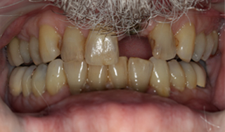 Dental Wellness LA | Botox reg , CBCT and E4D